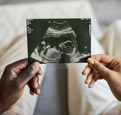 pregnancy scan